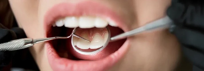 Comprehensive Dental Exams in South Gate CA