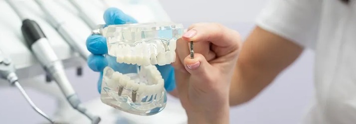 Dental Implants in South Gate CA